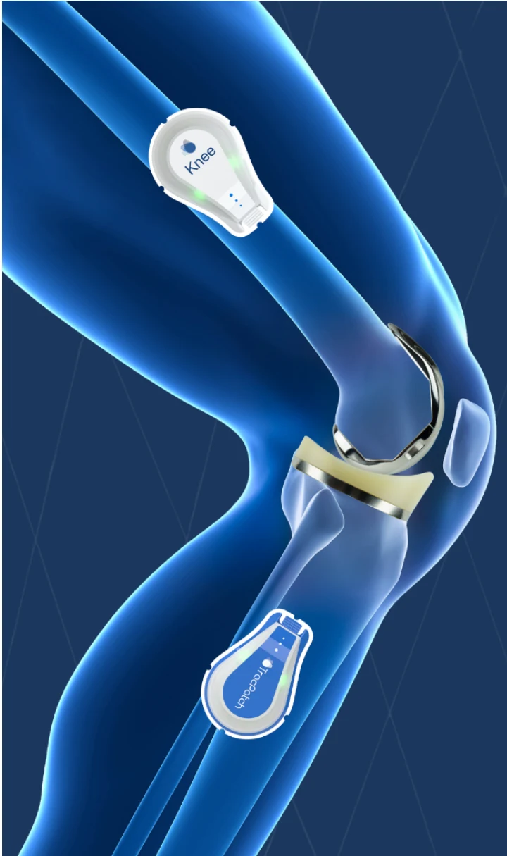Illustration of TracPatch measurement context across the knee joint